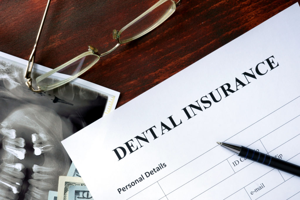 Will My Insurance Cover Dental Implants? Newport News VA Dentist